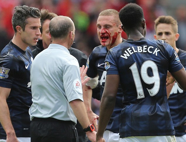 MU Tersingkir dari Kancah Liga Eropa